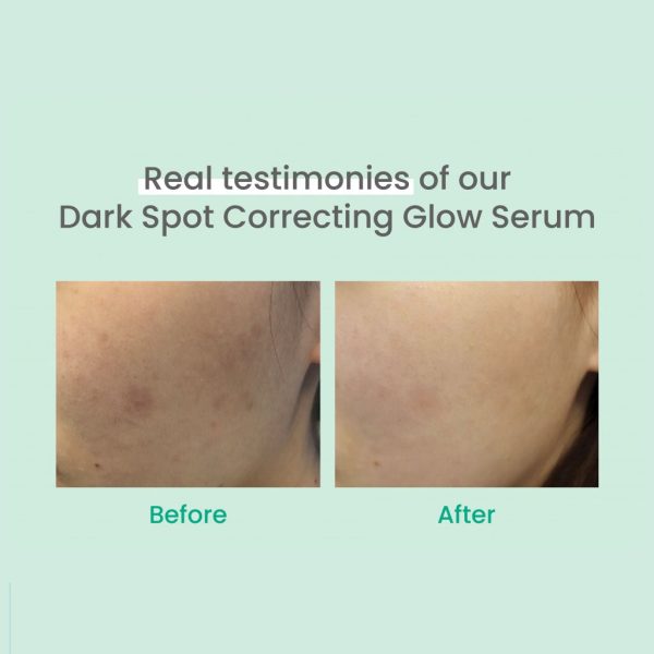 Dark Spot Correcting Glow Serum Cheap