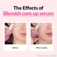 Blemish Care Up Serum For Discount